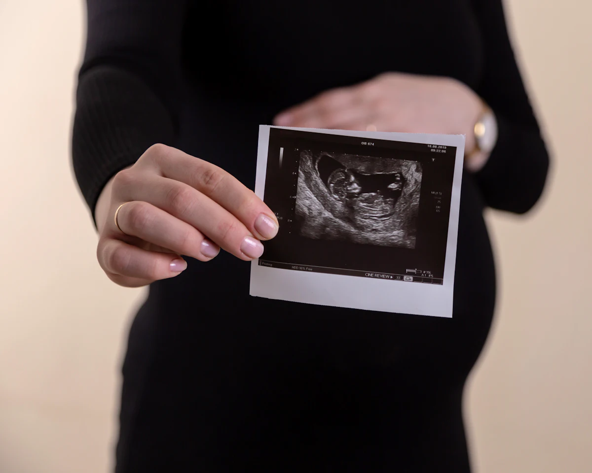 A pregnant woman holding an ultrasound scan picture